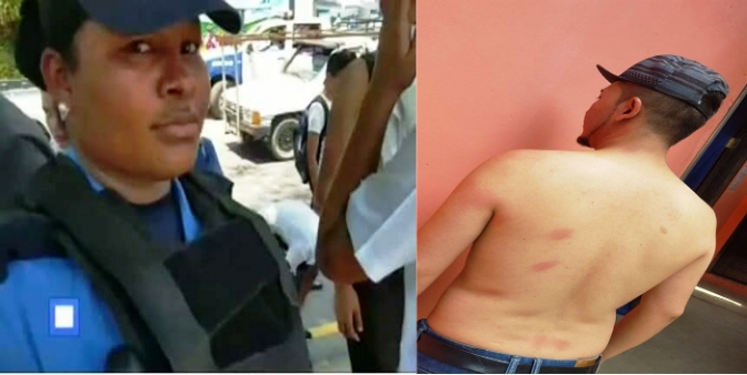 La agente que aparece en la foto a la izquierda es la que el periodista Ely Vallejo , con golpes en la foto de la derecha, es la que señala como una de las responsables de haberlo agredido. El ocultamiento de los nombres de los agentes que reprimen manifestaciones es una constante de impunidad en Honduras.
