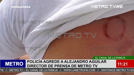 agresion a alejandro aguilar