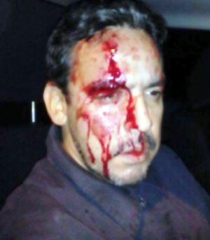 herido huelga