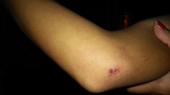 mujer golpeada1