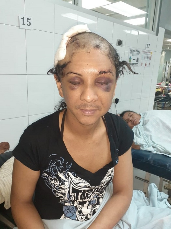 En espera de justicia por ataque recibido se encuentra la defensora trans Alejandra Vega Balenciaga
