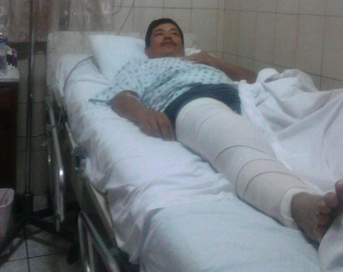 Víctor Vásquez. Presidente de MILPAH deberá estar tres meses en reposo después de operación por balazo en su rodilla en el desalojo violento contra campesinos de la Cooperativa 9 de Julio en San Pedro de Tutule, La Paz