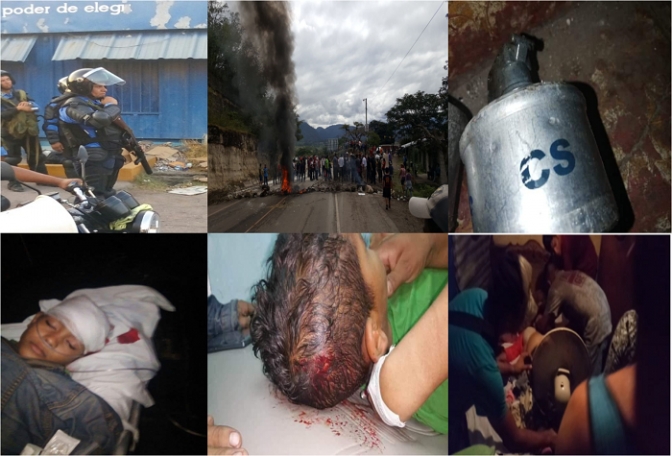 En las fotos de abajo tres de las víctimas de la represión policial: Un infante, un niño a quien la policía le lanzó piedras y quedó inconsciente y una señora del Barrio San Luís donde los cuerpos de seguridad lanzaron bombas lacrimógenas contra su casa.