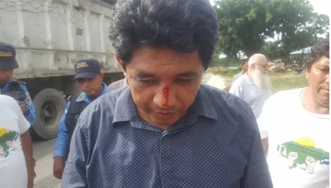 Coalición contra la Impunidad: Ministerio Público ha sido pieza clave en el incremento del conflicto en el sector de Pajuiles